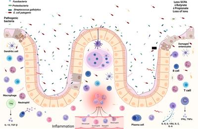 The synergistic interaction of systemic inflammation, dysbiosis and antimicrobial resistance promotes growth restriction in children with acute severe malnutrition: An emphasis on Escherichia coli